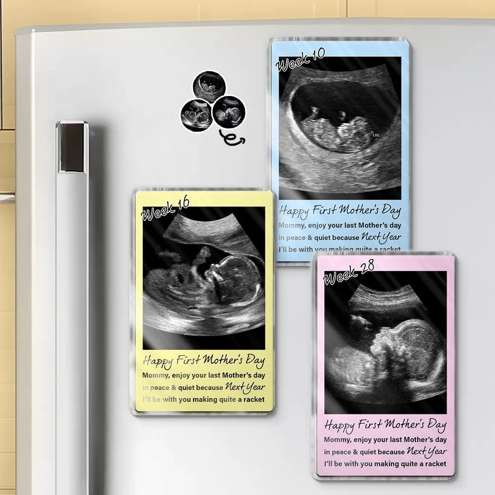 Custom Ultrasound Acrylic Fridge Magnet | White-Label, 1-Piece Minimum - Custom Acrylic Magnet Wholesale | POD Dropship Supplier | MCDFL